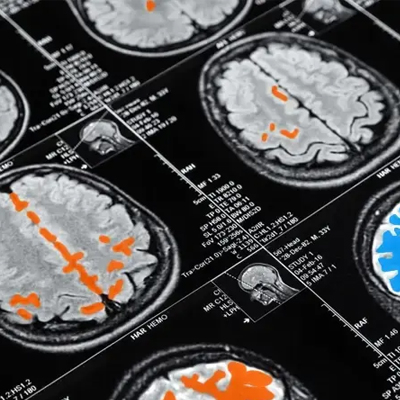 Healthcare Annotation